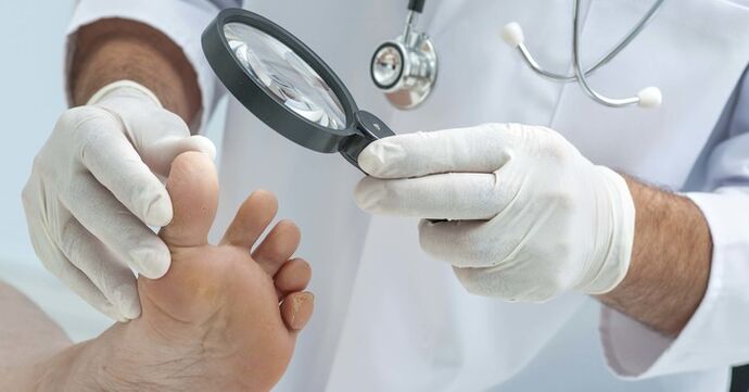 Diagnostické vyšetření nehtů na nohou